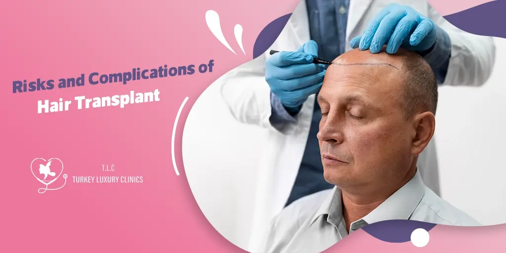 Risks and Complications of Hair Transplant