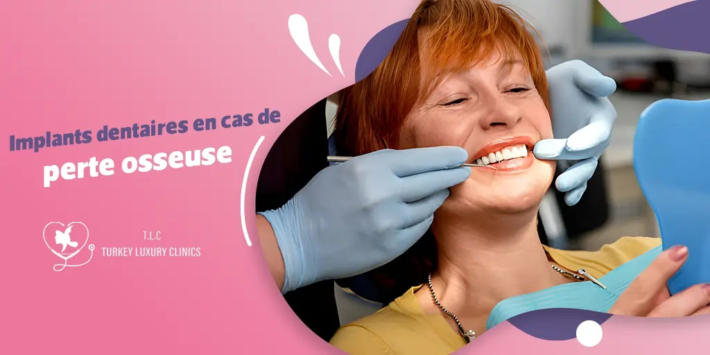 Implants dentaires en cas de perte osseuse