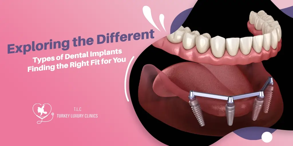 Exploring the Different Types of Dental Implants: Finding the Right Fit for You