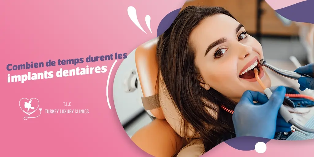 Combien de temps durent les implants dentaires ?