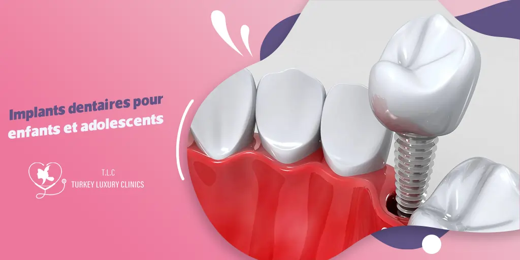 Implants dentaires pour enfants et adolescents