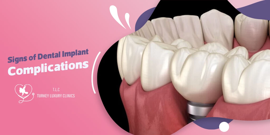 Signs of Dental Implant Complications