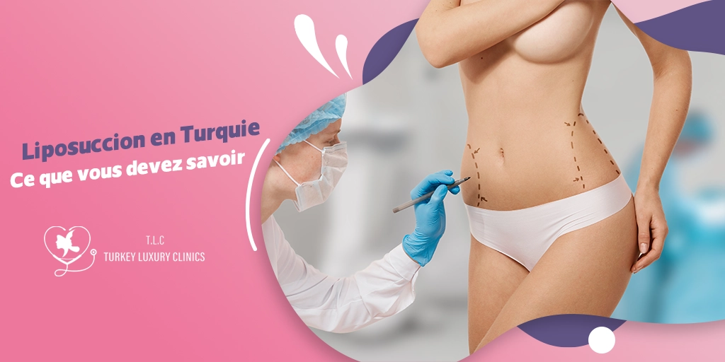 Liposuccion en Turquie : Ce que vous devez savoir