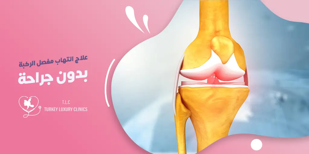 علاج التهاب مفصل الركبة بدون جراحة