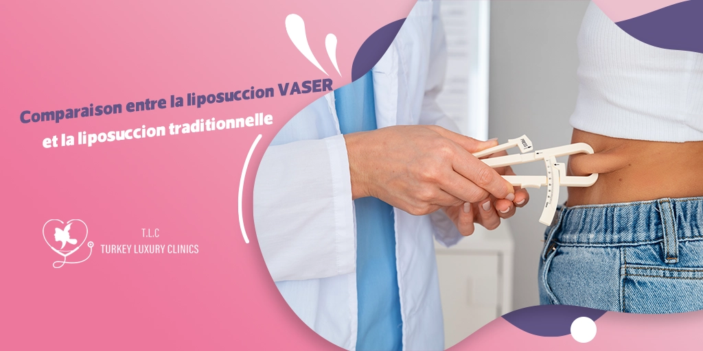 Liposuccion Vaser vs traditionnelle : Quelle option choisir?