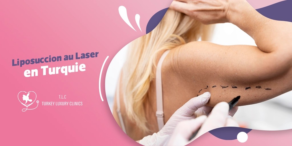 Liposuccion Laser en Turquie