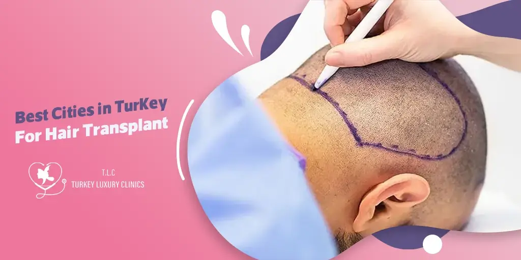 Best Cities in Turkey For Hair Transplant