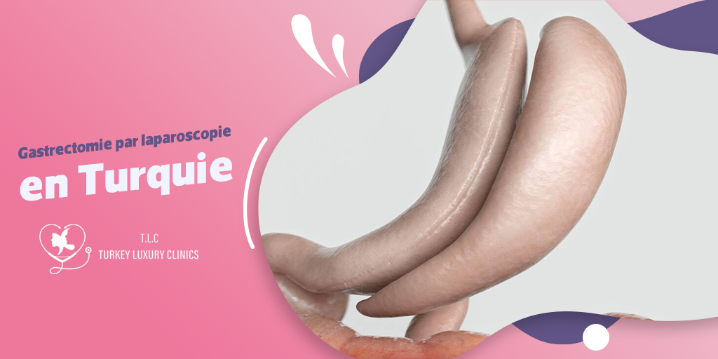 Gastrectomie par laparoscopie en Turquie : Solution mini-invasive et abordable